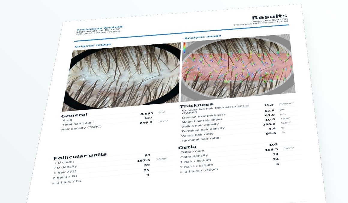 Perspective view of a TrichoScan FAST analysis report